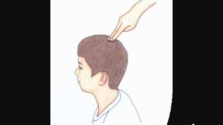 Autism and Acupressure [upl. by Adnael]