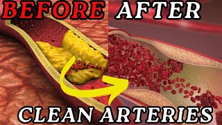 What to Eat to Clean Your Arteries [upl. by Guglielmo]