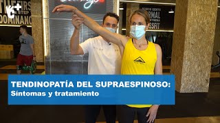 Tendininitis del supraespinoso qué es y qué hacer  CuídatePlus [upl. by Mines]