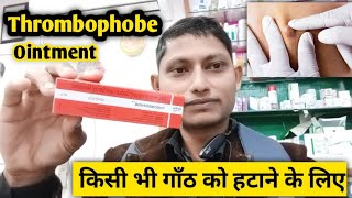 किसी भी प्रकार की गाँठ हो ऐसे ठीक होगी जैसे कभी थी ही नही  thrombophob kaise use kare Thrombophobe [upl. by Krug]