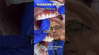 Why It’s IMPORTANT To Floss Your Teeth and Dental Bridge  View Mobile Dental shorts [upl. by Laehcim]