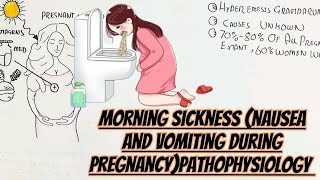 Morning SicknessHyperEmesis Gravidarum pregnancy symptomsPathophysiology [upl. by Sokairyk979]