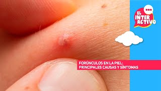 Infecciones cutáneas diferencias entre forúnculos quistes y absceso [upl. by Ahsatsana]