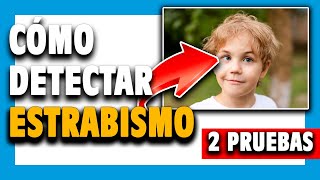 🔵 ¿Cómo saber si tengo ESTRABISMO 👉 Para niños y adultos [upl. by Lati808]