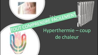 Urgences  la lecon avec cedille  hyperthermie coup de chaleur 🫨🥵 [upl. by Sullecram]