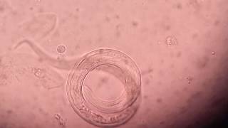 Live Strongyloides under sputum saline wet mount [upl. by Herschel]