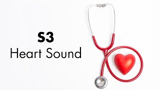 S3 Heart Sound  MEDZCOOL [upl. by Ielerol843]