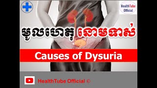 មូលហេតុ នោមទាស់ l Causes of dysuria l HealthTube Official [upl. by Yras293]