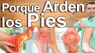 Porqué Me Arden Los Pies  Causas Y Soluciones Para El Ardor Y Dolor En Los Pies [upl. by Paik]