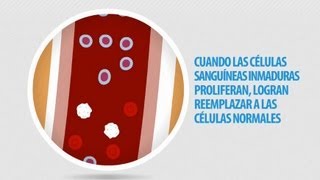 Informacion de la Leucemia [upl. by Ana]