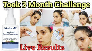 Wishcare Hair Growth Serum Review  3 Month Experience ⛔ Non Sponsored ⛔ [upl. by Aneerol]