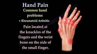 Hand and Finger Pain Common Causes and Symptoms Explained [upl. by Belen]