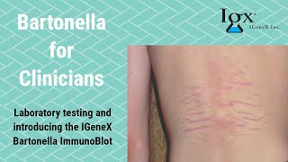 Introducing IGeneX Bartonella ImmunoBlots [upl. by Zetneuq]