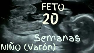 Es niño ❤️❤️ FETO 20 SEMANAS EMBARAZO 🤰 Desarrollo video ecografía en 3d💖 5º mes [upl. by Meridel]