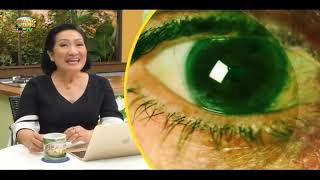 Healing Galing S16EP12  Eye Special Episode part3 [upl. by Rollie]