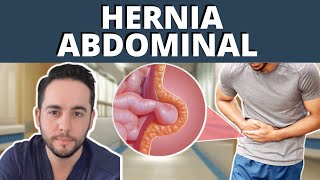 Complicaciones de las hernias hernia inguinal umbilical abdominal etc [upl. by Seugram]