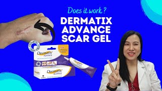 How To Reduce Scars with Dermatix Advanced Scar Gel [upl. by Assecnirp]