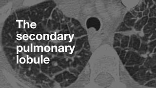 The Secondary Pulmonary Lobule [upl. by Pasahow]