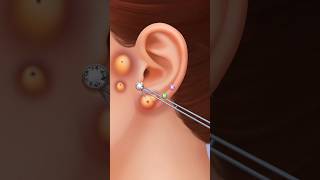 ASMR ear treatment piercing pus clean amp ear pimple removal animation hkASMRtreatment [upl. by Annazor]