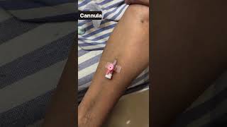 Properly cannula insertion shortvideo cannulation intravenous injection nursing trending [upl. by Aynom]