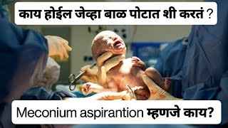 Meconium Aspiration Syndrome explained in Marathi  बाळाने पोटात शी केली [upl. by Nevada650]