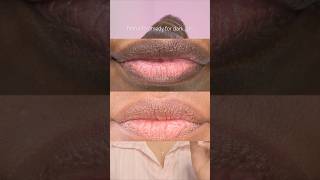 Dark lips remedy naturalremedy malluvlogger malayalambeautytips malayalambeautychannel lipcare [upl. by Assiruam]