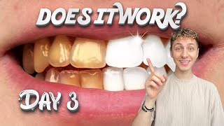 Testing the ‘viral’ TEETH WHITENING STRIPS Day3 [upl. by Geffner462]