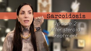 Sarcoidosis update 2 After topical steroid treatment [upl. by Valdemar]