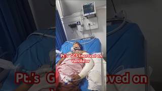 Patient On Ventilator Support ventilatorpatienticudoctorviralvideoshortsvideo [upl. by Nwahsud]