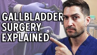 Gallbladder Surgery Explained  Complications and Recovery [upl. by Barnard]