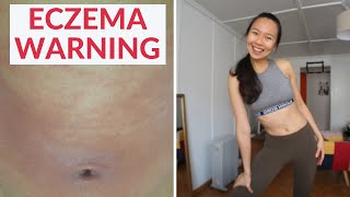 ECZEMA SKIN CARE [upl. by Evanne]