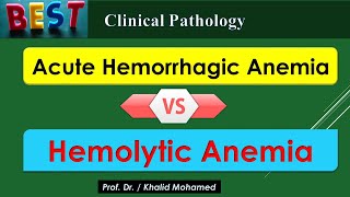 Acute Hemorrhagic Anemia VS Hemolytic Anemia [upl. by Asseret]