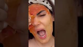 Remove Acne amp Pigmentation Naturally At Home Get Clear amp Spotless Skin beautiful skincare shorts [upl. by Ocsicnarf]