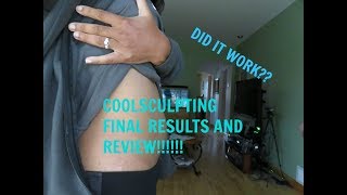 Coolsculpting FINAL RESULTS Before and after Pic [upl. by Ysus]