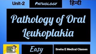 Pathology of Oral leukoplakia  Hindi [upl. by Ylle]