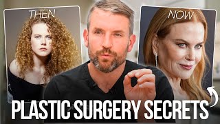 Has Nicole Kidman Had Work Done  Plastic Surgery Secrets [upl. by Sivram]