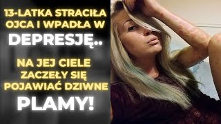 13latka straciła ojca i wpadła w depresję Na jej ciele zaczęły pojawiać się dziwne plamy [upl. by Lowson]