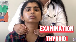 Clinical Examination of Thyroid Gland  OSCE Guide Clinical skills [upl. by Selfridge]