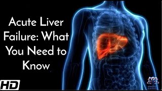 Acute Liver Failure What You Need To Know [upl. by Bass]