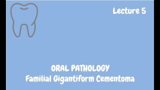 Familial Gigantiform Cementoma Complete Lecture  For NBDE NDEB MDS amp FCPS [upl. by Naro]