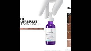 Fade Dark Spots on Hands and Body with Advanced Clinicals Dark Spot Vitamin C Cream Anti Aging [upl. by Merlin]