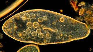 Amazing Microscopic HD Video Paramecium Feeding [upl. by Novikoff418]