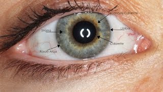 How to get the best artificial eye treatment [upl. by Elisabet499]