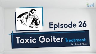 Toxic Goiter  Treatment  05  Surgery  Prof Ashraf Khater [upl. by Deys329]