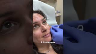 ¿Te molestan las ojeras En Numed te podemos ayudar 💉 [upl. by Eldridge963]