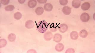 How to Pronounce Vivax [upl. by Awad100]