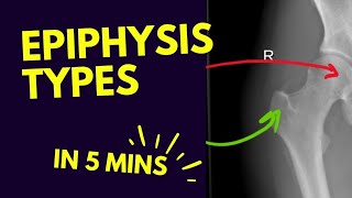 Types of Epiphysis 🦴  In FIVE 5️⃣ Minutes [upl. by Adyan730]