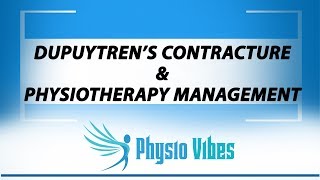 DUPUYTRENS CONTRACTURE amp PHYSIOTHERAPY MANAGEMENT [upl. by Lepper]