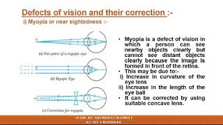 Class 10 Defects of vision and their correction by Mrs Shubhda Chamoli [upl. by Hoi]