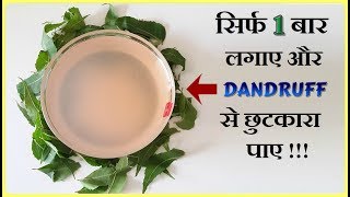 Dandruff  The Best Dandruff Treatment At Home  Dandruff Home Remedies In Hindi [upl. by Leelahk]